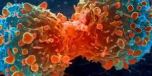 Ученые взялись за исследование природы рака легких