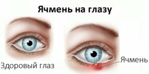 Воспалительные заболевания глаз: список, симптомы и лечение