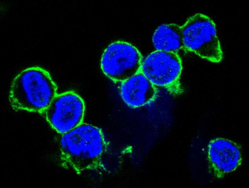 Что такое пептидная связь и серповидно-клеточная анемия