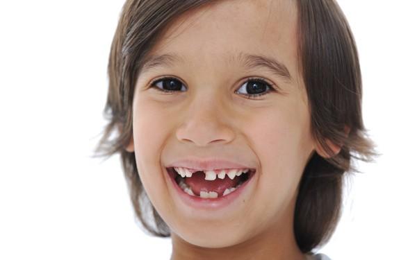 Как вырвать молочный зуб? Показания к удалению молочных зубов у детей