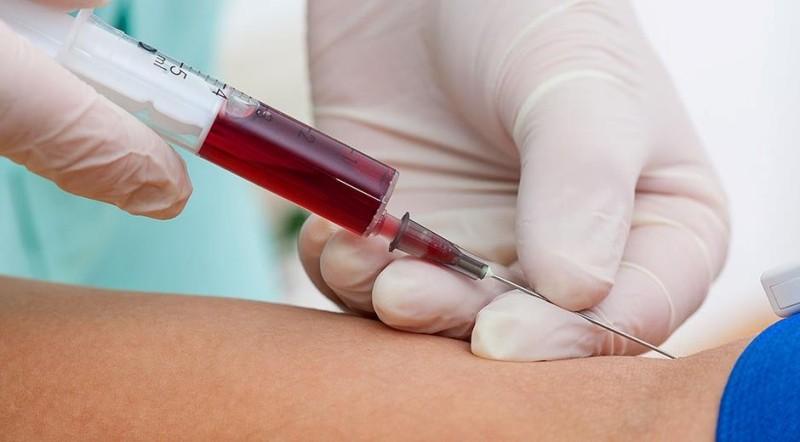 Норма инсулина натощак для взрослых и детей. Что показывает анализ крови на инсулин